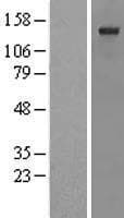 SSFA2 Protein (Over-Expression Lysate Myc-DDK (Flag))