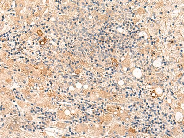 Polyclonal Rabbit anti-Human SULT4A1 / Sulfotransferase 4A1 Antibody (IHC)