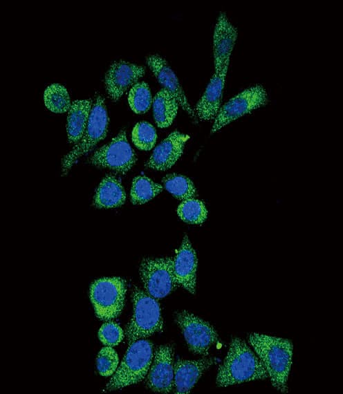 Polyclonal Rabbit anti-Human GLA / Alpha Galactosidase Antibody (aa83-112, IHC, IF, WB)