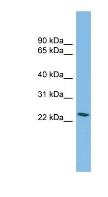 SSX4 Antibody (aa71-120)