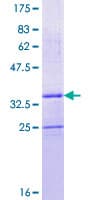 Human SEPX1 / Selenoprotein R (Recombinant GST)