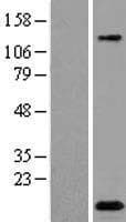 C2orf88 Protein (Over-Expression Lysate Myc-DDK (Flag))