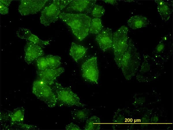 GCLC Antibody (clone 3H1)