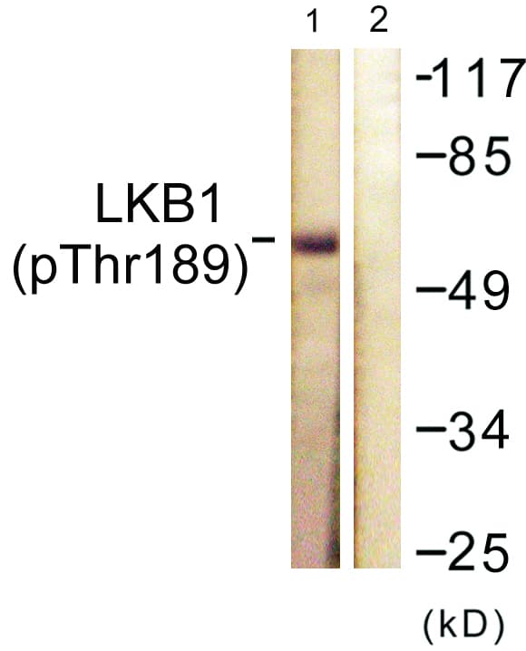 Polyclonal Rabbit anti-Human STK11 / LKB1 Antibody (phospho-Thr189, WB)