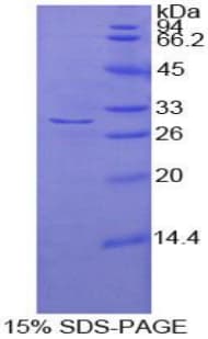 Human ADCY2 / Adenylate Cyclase 2 Protein (Recombinant 6His, N-terminus)