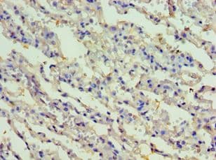 RIPK3 / RIP3 Antibody (aa1-120)