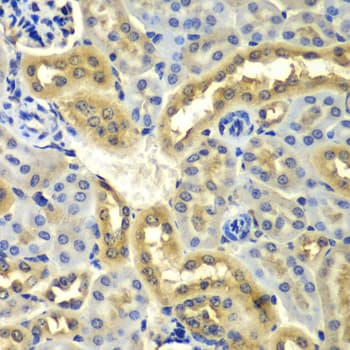 SYNCRIP / HnRNP Q Antibody