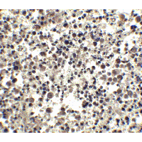 Polyclonal Rabbit anti-Human CIDEA / CIDE-A Antibody (IHC, IF, WB)