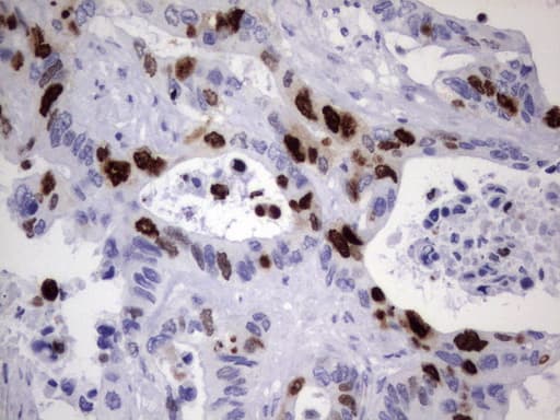 TOP2A / Topoisomerase II Alpha Antibody (aa1100-1531, clone UMAB146)