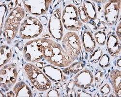 PIM2 / Pim-2 Antibody (clone OTI5D5)