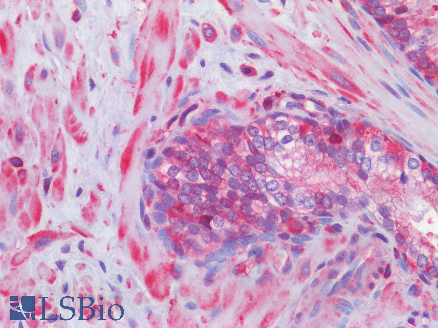 IHC-plus™ SMO / Smoothened Antibody (aa68-117)