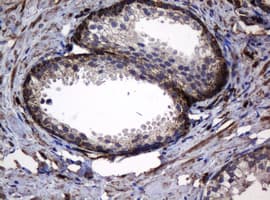 HSPD1 / HSP60 Antibody (clone OTI3G1)