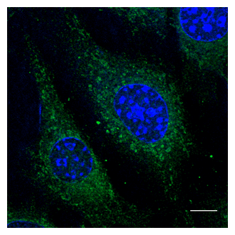 PathPlus™ RAB5A / RAB5 Antibody (C-Terminus)