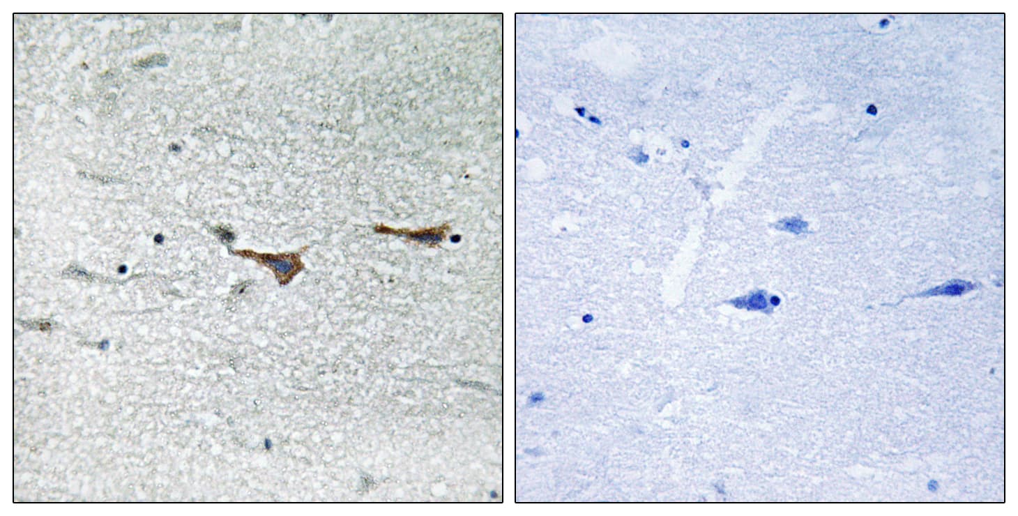 TOB1 / TOB Antibody (aa130-179)