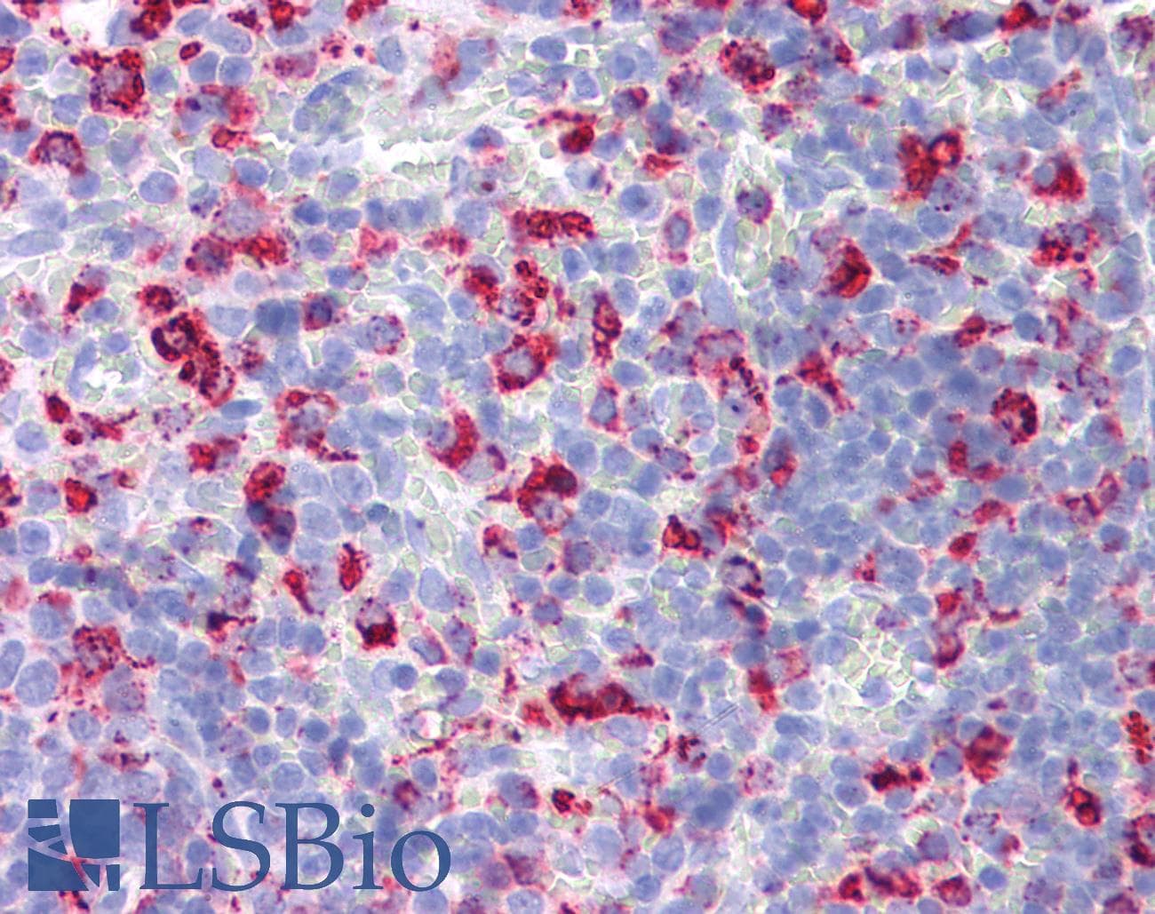 IHC-plus™ Monoclonal Mouse anti-Rat CD68 Antibody (clone ED1, IHC)
