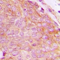 CHKB / CHKL Antibody (C-Terminus)