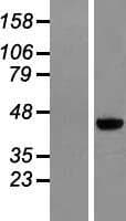 MAGEB6 Protein (Over-Expression Lysate Myc-DDK (Flag))