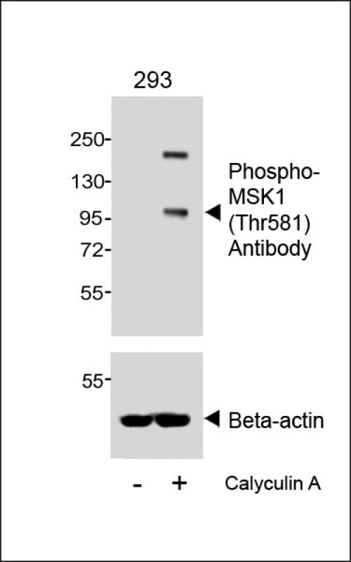 RPS6KA5 / MSK1 Antibody (phospho-Thr581)