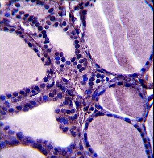 Polyclonal Rabbit anti-Human TRIM23 Antibody (aa147-175, IHC, WB)
