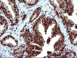 UPRT Antibody (clone OTI2D1)