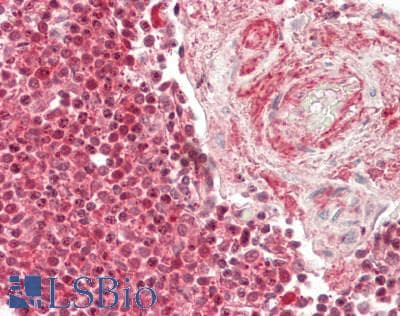 IHC-plus™ Polyclonal Rabbit anti-Human PSMB9 Antibody (aa193-219, IHC, WB)