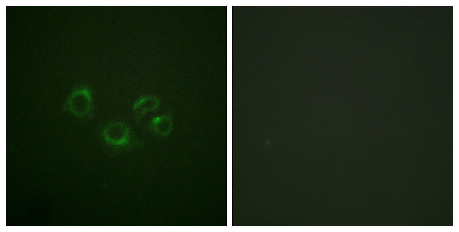 Polyclonal Rabbit anti-Human EPH Receptor A2+A3+A4 Antibody (Internal, IF, WB)