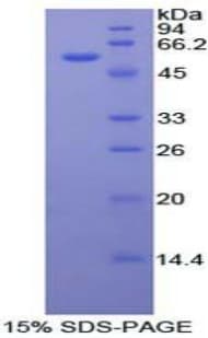 Mouse FOXP3 Protein (Recombinant His-GST)