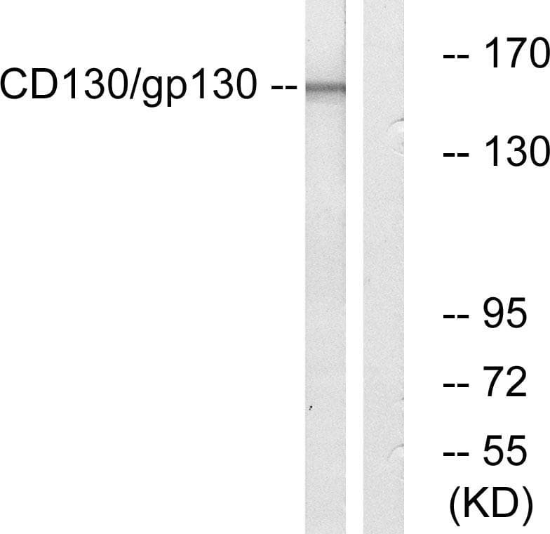 Polyclonal Rabbit anti-Human IL6ST / CD130 / gp130 Antibody (p782, IHC, IF, WB)