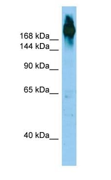 Polyclonal Rabbit anti-Human ABP-280 / FLNC Antibody (aa586-635, WB)