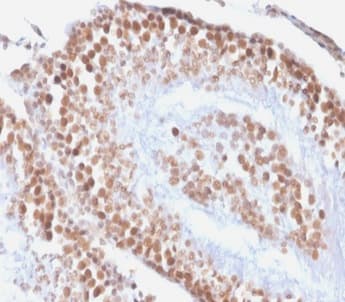Recombinant Monoclonal Mouse anti-Human WT1 / Wilms Tumor 1 Antibody (clone rWT1/857, Azide-free,Carrier-free, IHC)