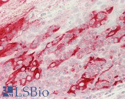 IHC-plus™ MSLN / Mesothelin Antibody (aa 37-598)