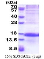 Human PCP4L1 Protein (Recombinant His)