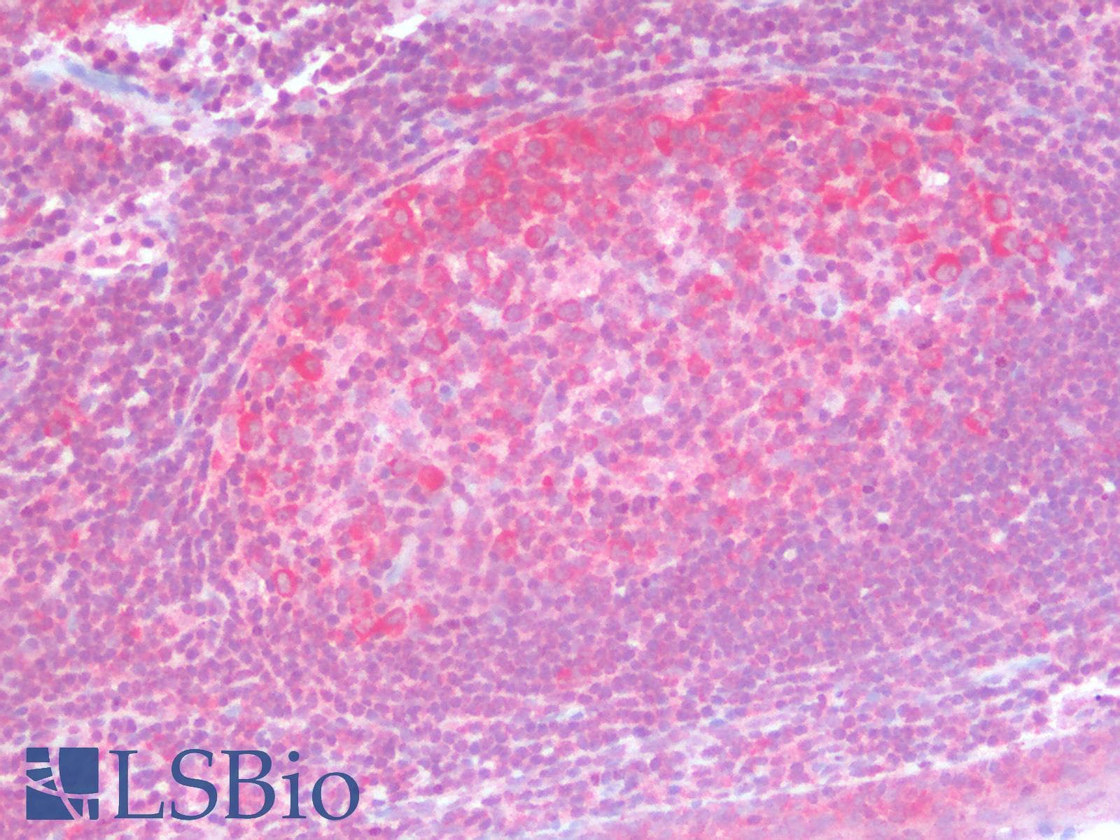 PathPlus™ p16INK4a / CDKN2A Antibody (aa1-60)
