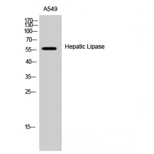 LIPC / Hepatic Lipase Antibody (270-350 aa, Internal)