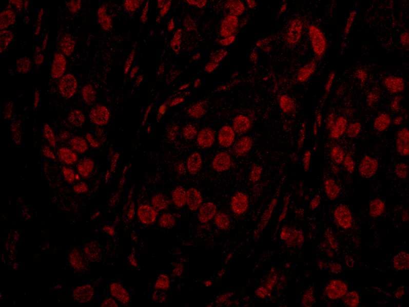 TOPORS Antibody (aa995-1045)