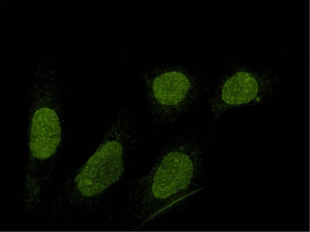 SUN1 Antibody