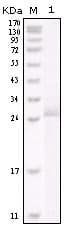 ERBB2 / HER2 Antibody (clone 9B9D8)