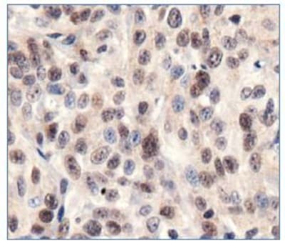 SIRT1 / Sirtuin 1 Antibody