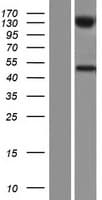 UGT2B10 Protein (Over-Expression Lysate Myc-DDK (Flag))