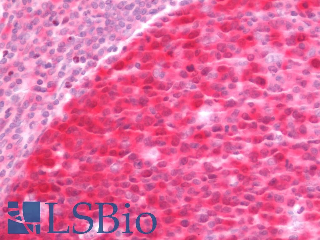 IHC-plus™ PBK / TOPK Antibody (clone 2C8)