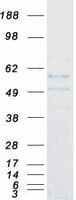 Human FIZ1 Protein (Recombinant Myc-DDK (Flag))