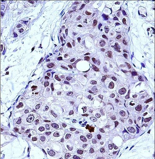 Polyclonal Rabbit anti-Human MYB / c-Myb Antibody (aa419-448, IHC, WB)