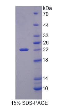Mouse PHF8 Protein (Recombinant His-T7)