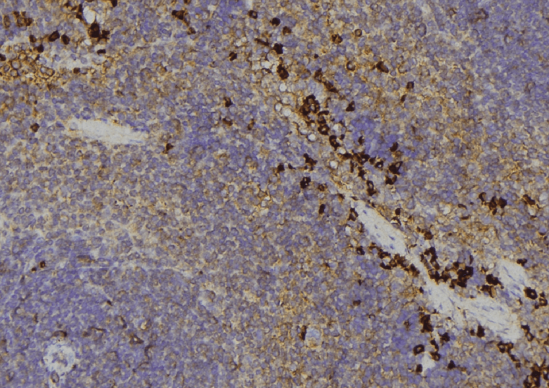 AKR1C4 / Chlordecone Reductase Antibody