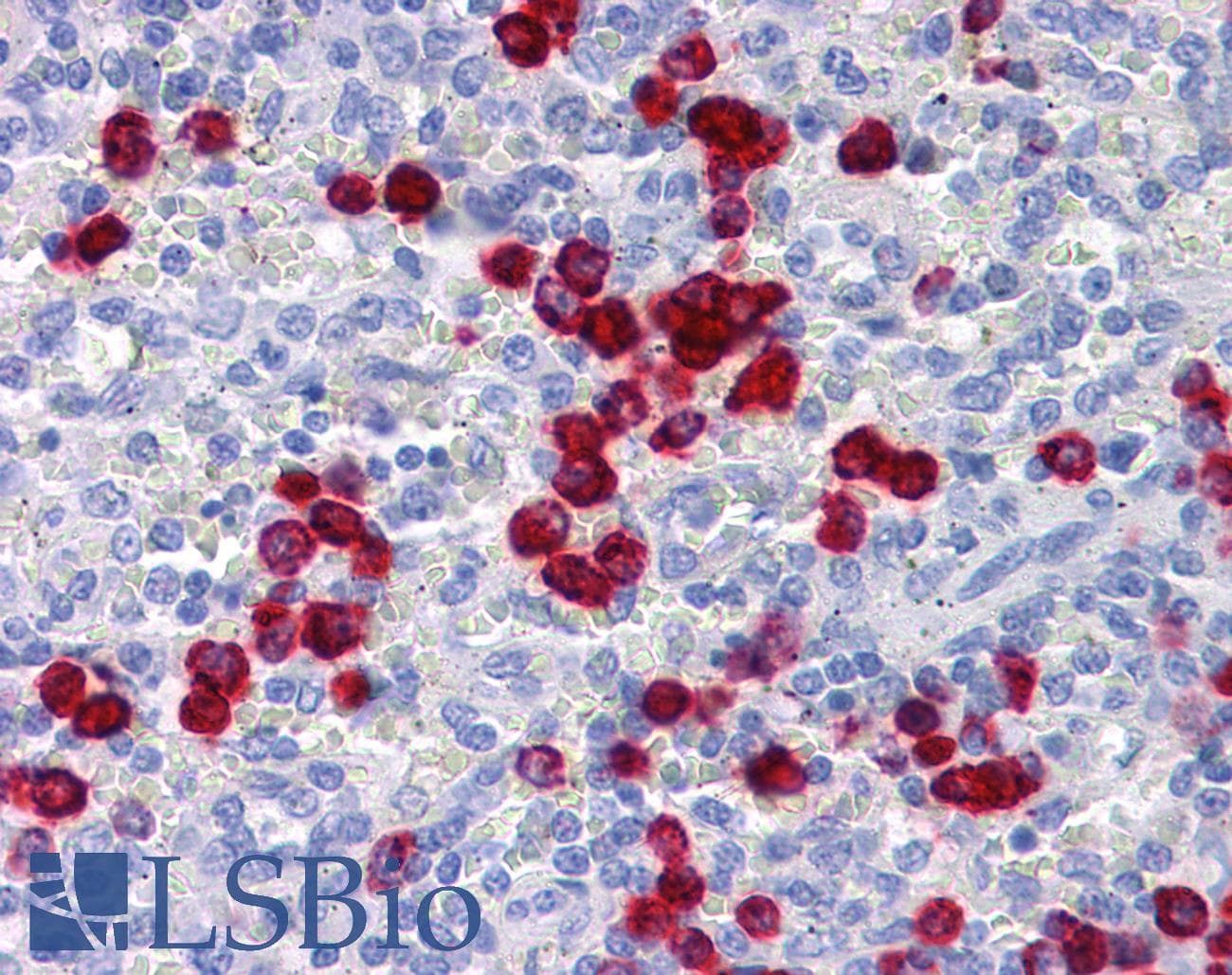 IHC-plus™ Monoclonal Mouse anti-Human CDH18 / Ey-Cadherin Antibody (clone 6F7, IHC, WB)