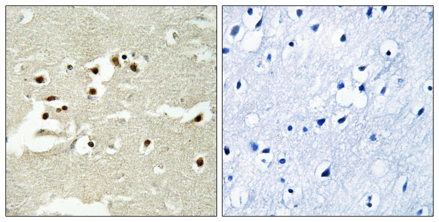 NCOA5 Antibody