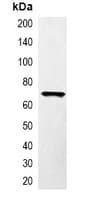 RFP Tag Antibody