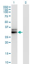 HMGCL Antibody (clone 4F4-D1)