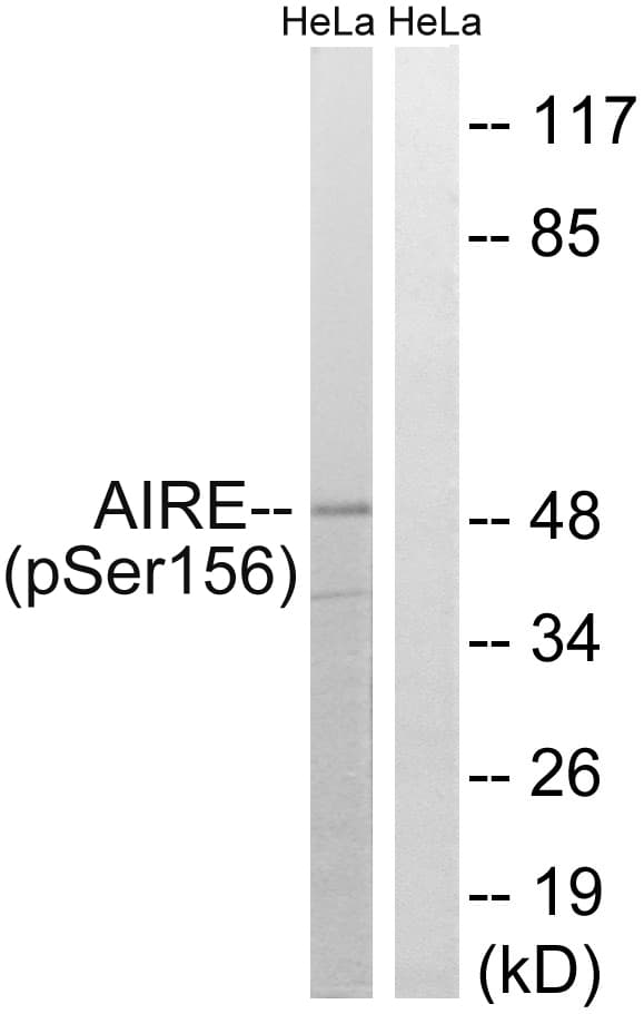 AIRE Antibody (phospho-Ser156)