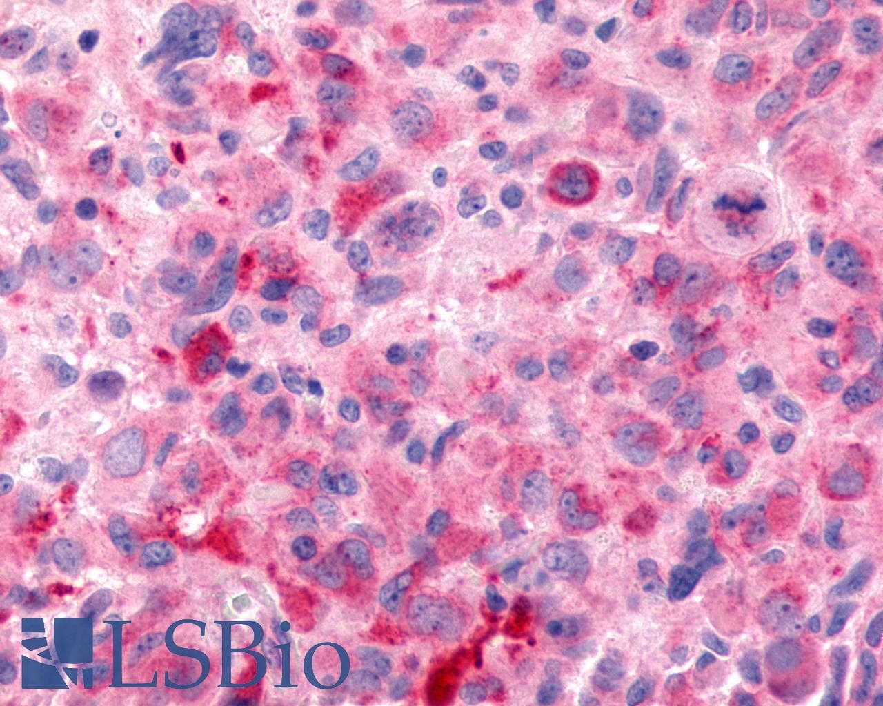 PathPlus™ Polyclonal Rabbit anti-Human FZD6 / Frizzled 6 Antibody (N-Terminus, IHC)